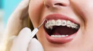 Kieferorthopädische Behandlung - Malatya Diş