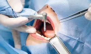 Oral and Dental Surgery Malatya